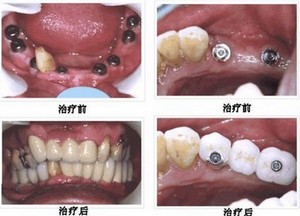 1-1504091FU9559.jpg