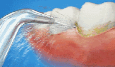 09302324I-1.gif