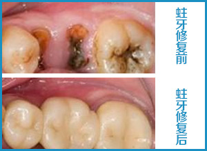 1-15042GH315543.jpg