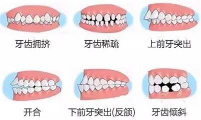1-1ZH50935163A.jpg