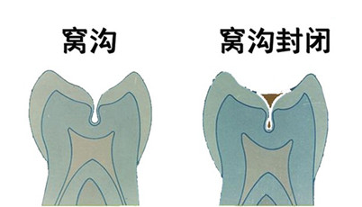 e131301288cda3ab6d7384641ab6bac.png